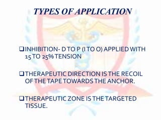TYPES OFAPPLICATION
INHIBITION- DTO P (ITO O) APPLIEDWITH
15TO 25%TENSION
THERAPEUTIC DIRECTION ISTHE RECOIL
OFTHETAPETOWARDSTHE ANCHOR.
THERAPEUTIC ZONE ISTHETARGETED
TISSUE.
 