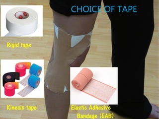 Elastic Adhesive
Bandage (EAB)
Rigid tape
Kinesio tape
CHOICE OF TAPE
 