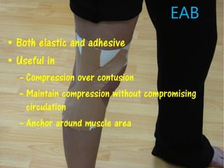 EAB
• Both elastic and adhesive
• Useful in
– Compression over contusion
– Maintain compression without compromising
circulation
– Anchor around muscle area
 