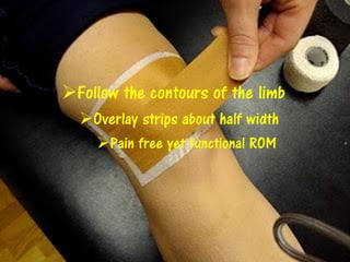 Follow the contours of the limb
Overlay strips about half width
Pain free yet functional ROM
 