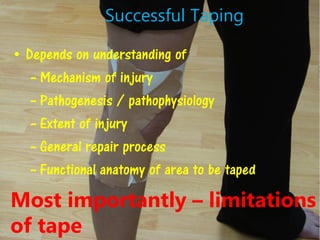 Successful Taping
• Depends on understanding of
– Mechanism of injury
– Pathogenesis / pathophysiology
– Extent of injury
– General repair process
– Functional anatomy of area to be taped
Most importantly – limitations
of tape
 