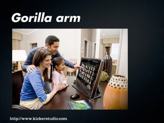 Gorilla arm
 