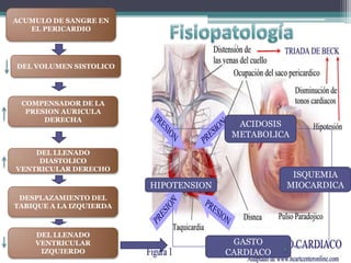 Taponamiento cardíaco