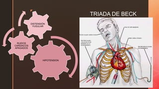 z
TRIADA DE BECK
HIPOTENSION
RUIDOS
CARDIACOS
APAGADOS
DISTENSIÓN
YUGULAR
 
