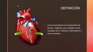 z
DEFINICIÓN
 por la acumulación en el pericardio de
líquido, coágulos, pus o sangre, como
resultado de un derrame, traumatismo o
rotura cardíaca
 