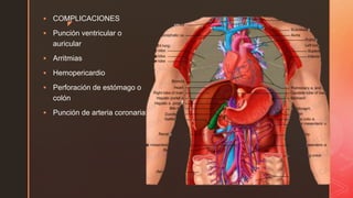 z
 COMPLICACIONES
 Punción ventricular o
auricular
 Arritmias
 Hemopericardio
 Perforación de estómago o
colón
 Punción de arteria coronaria
 