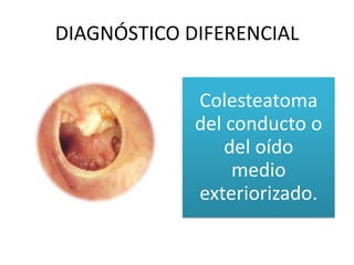 DIAGNÓSTICO DIFERENCIAL