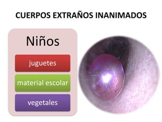 CUERPOS EXTRAÑOS INANIMADOS
