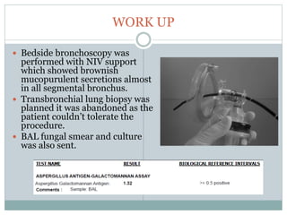 WORK UP
 Bedside bronchoscopy was
performed with NIV support
which showed brownish
mucopurulent secretions almost
in all segmental bronchus.
 Transbronchial lung biopsy was
planned it was abandoned as the
patient couldn’t tolerate the
procedure.
 BAL fungal smear and culture
was also sent.
 