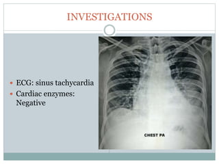 INVESTIGATIONS
 ECG: sinus tachycardia
 Cardiac enzymes:
Negative
 