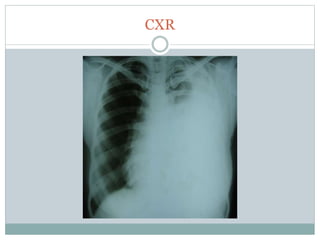 CXR
 