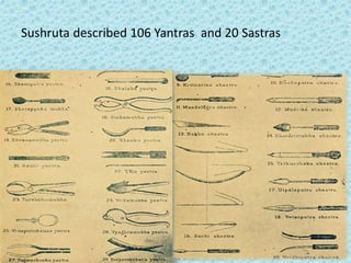 Sushruta described 106 Yantras and 20 Sastras
 