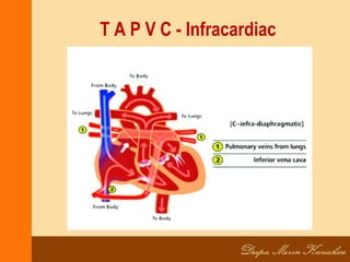 T A P V C - Infracardiac
 