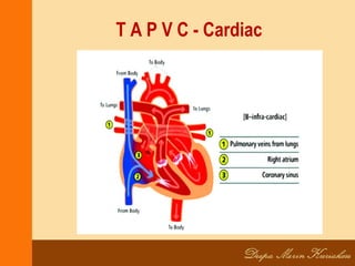 T A P V C - Cardiac
 