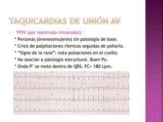  TPSV (por reentrada intranodal):
* Personas jóvenes(mujeres) sin patología de base.
* Crisis de palpitaciones rítmicas seguidas de poliuria.
* “Signo de la rana”: nota pulsaciones en el cuello.
* No asocian a patología estructural. Buen Px.
* Onda P’ se mete dentro de QRS. FC> 180 Lpm.
 