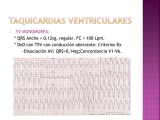  TV MONOMORFA:
* QRS Ancho > 0,12sg, regular, FC > 100 Lpm.
* DxD con TSV con conducción aberrante: Criterios Dx
-Disociación AV; QRS>0,14sg;Concordancia V1-V6.
 