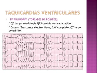  TV POLIMORFA (TORSADES DE POINTES):
* QT Largo, morfología QRS cambia con cada latido.
* Causas: Trastornos electrolíticos, BAV completo, QT largo
congénito.
 