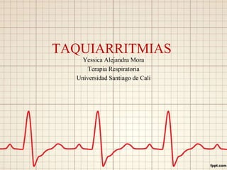 TAQUIARRITMIAS
Yessica Alejandra Mora
Terapia Respiratoria
Universidad Santiago de Cali
 