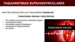 TAQUIARRITMIAS SUPRAVENTRICULARES
MÁS FRECUENTES SON LAS TAQUICARDIAS SINUSALES
TAQUICARDIA SINUSAL FISIOLÓGICAS
▪ Por estados de activación catecolaminérgica
▪ Acompaña la fiebre
▪ Acompaña estados fisiológicos
▪ Acompaña el Hipertiroidismo
▪ Es rítmica
 
