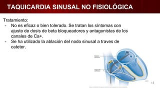 TAQUICARDIA SINUSAL NO FISIOLÓGICA
Tratamiento:
- No es eficaz o bien tolerado. Se tratan los síntomas con
ajuste de dosis de beta bloqueadores y antagonistas de los
canales de Ca+.
- Se ha utilizado la ablación del nodo sinusal a traves de
cateter.
 
