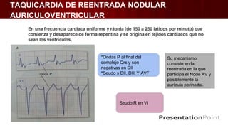 TAQUICARDIA DE REENTRADA NODULAR
AURICULOVENTRICULAR
Su mecanismo
consiste en la
reentrada en la que
participa el Nodo AV y
posiblemente la
aurícula perinodal.
En una frecuencia cardíaca uniforme y rápida (de 150 a 250 latidos por minuto) que
comienza y desaparece de forma repentina y se origina en tejidos cardíacos que no
sean los ventrículos.
*Ondas P al final del
complejo Qrs y son
negativas en DII
*Seudo s DII, DIII Y AVF
Seudo R en VI
 