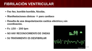 FIBRILACIÓN VENTRICULAR
 