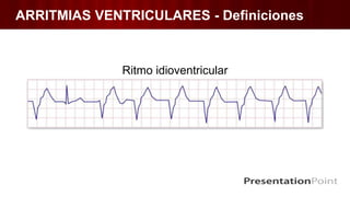 Ritmo idioventricular
ARRITMIAS VENTRICULARES - Definiciones
 