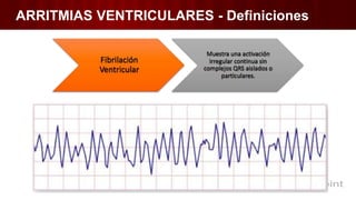 ARRITMIAS VENTRICULARES - Definiciones
 