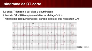 síndrome de QT corto
La onda T tienden a ser altas y acuminadas
intervalo QT <320 ms para establecer el diagnóstico
Tratamiento con quinidina post parada cardiaca que necesiten DAI
 