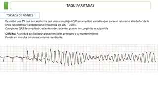 TAQUIARRITMIAS
TORSADA DE POINTES
Describe una TV que se caracteriza por unos complejos QRS de amplitud variable que parecen retorerse alrededor de la
línea isoeléctrica y alcanzan una frecuencia de 200 – 250 x’.
Complejos QRS de amplitud creciente y decreciente, puede ser congénita o adquirida
ORÍGEN: Actividad gatillada por pospotenciales precoces y su mantenimiento
Puesta en marcha de un mecanismo reentrante
 