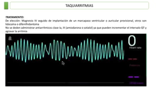TAQUIARRITMIAS
TRATAMIENTO:
De elección: Magnesio IV seguido de implantación de un marcapaso ventricular o auricular provisional, otros son
lidocaína o difenilhidantoína
No se deden administrar antiarrítmicos clase Ia, III (amiodarona o sotalol) ya que pueden incrementar el intervalo QT y
agravar la arritmia.
 