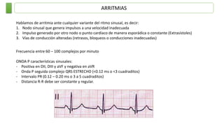 ARRITMIAS
Hablamos de arritmia ante cualquier variante del ritmo sinusal, es decir:
1. Nodo sinusal que genera impulsos a una velocidad inadecuada
2. Impulso generado por otro nodo o punto cardíaco de manera esporádica o constante (Extrasístoles)
3. Vías de conducción alteradas (retrasos, bloqueos o conducciones inadecuadas)
Frecuencia entre 60 – 100 complejos por minuto
ONDA P características sinusales:
- Positiva en DII, DIII y aVF y negativa en aVR
- Onda P seguida complejo QRS ESTRECHO (<0.12 ms o <3 cuadraditos)
- Intervalo PR (0.12 – 0.20 ms o 3 a 5 cuadraditos)
- Distancia R-R debe ser constante y regular.
 