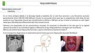 TAQUIARRITMIAS
TAQUICARDIA AURICULAR
UNIFOCAL
Es un ritmo ectópico debido a la descarga rápida y repetitiva de un solo foco auricular a una frecuencia auricular
generalmente entre 140-220 (100-240) por minuto, lo cual puede servir para que la sospechemos ante dude de que
pueda ser una Taquicardia Sinusal que normalmente es inferior a 160 lpm, ya que al tener el estimulo un solo origen
existe gran dificultad para diferenciarlo del rimo sinusal normal.
Veremos una taquicardia con las características sinusales. En ocasiones la velocidad es tan alta que no se logrará
apreciar las ondas P, con maniobras vagales o Adenosina (6 mg-12mg) podremos conseguir que se produzca
BAV lo cual orienta hacia Taquicardia Auricular, o que se enlentezca y veamos la ondas P.
Si lo conseguimos diagnosticar el tratamiento será el mismo que en la Taquicardia Auricular Multifocal
 