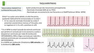TAQUIARRITMIAS
TAQUICARDIA PAROXÍSTICA
SUPRAVENTRICULAR (TPSV)
Suelen producirse por dos mecanismos principalmente:
- Reentrada Intranodal (60% de las TPSV)
- Reentrada por vía accesoria (la mas frecuente es el Wolff Parkinson White- WPW)
Onda P no suelen verse debido a la alta frecuencia,
quedando habitualmente enmascaradas en la onda T.
• En los casos de reentrada intranodal las ondas P
presentan características inversas a P Sinusales, esto
es negativas en II, III y aVF, y positivas en aVR.
* En el WPW la onda P procede de estimulo ventricular
que penetra en aurículas por la vía accesoria y vuelve a
despolarizar ventrículos por nodo AV (conducción
ORTODROMICA, 90%) o llega a aurículas por nodo AV y
estimula ventrículos por vía accesoria (Conducción
ANTRIDROMICA).
En el WPW con conducción Ortodrómica QRS estrecho y en
la Antidromica QRS ancho
 