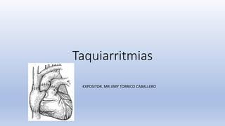 Taquiarritmias
EXPOSITOR. MR JIMY TORRICO CABALLERO
 
