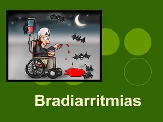 Bradiarritmias 