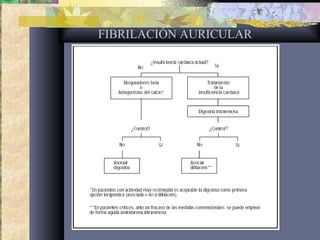 FIBRILACIÓN AURICULAR
 