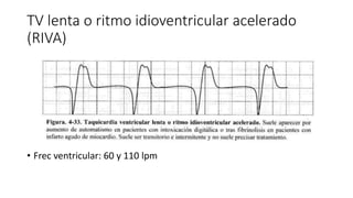 Ritmo Riva TAQUIARRITMIAS SUPRAVENTRICULARES CLASIFICACION.pptx
