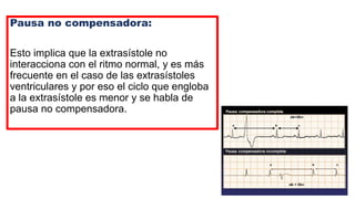 Pausa no compensadora:
Esto implica que la extrasístole no
interacciona con el ritmo normal, y es más
frecuente en el caso de las extrasístoles
ventriculares y por eso el ciclo que engloba
a la extrasístole es menor y se habla de
pausa no compensadora.
 