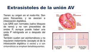Extrasístoles de la unión AV
Tienen su origen en el nodo-His. Son
poco frecuentes, y se asocian a
intoxicación digitálica.
Los QRS son normales (salvo bloqueo
de rama) y no van precedidos de
ondas P, aunque puede haber una
onda P retrógrada en o después del
QRS.
También suelen ser asintomáticos y no
requieren tratamiento (excepto el de la
intoxicación digitálica si existe) y si son
sintomáticos se emplean betabloqueantes.
 