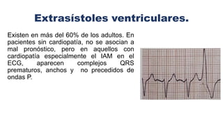 Extrasístoles ventriculares.
Existen en más del 60% de los adultos. En
pacientes sin cardiopatía, no se asocian a
mal pronóstico, pero en aquellos con
cardiopatía especialmente el IAM en el
ECG, aparecen complejos QRS
prematuros, anchos y no precedidos de
ondas P.
 
