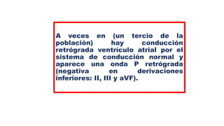 A veces en (un tercio de la
población) hay conducción
retrógrada ventrículo atrial por el
sistema de conducción normal y
aparece una onda P retrógrada
(negativa en derivaciones
inferiores: II, III y aVF).
 