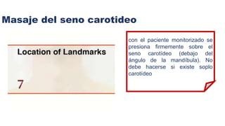 Masaje del seno carotideo
con el paciente monitorizado se
presiona firmemente sobre el
seno carotídeo (debajo del
ángulo de la mandíbula). No
debe hacerse si existe soplo
carotídeo
 