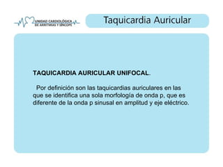 TAQUICARDIA AURICULAR UNIFOCAL.

 Por definición son las taquicardias auriculares en las
que se identifica una sola morfología de onda p, que es
diferente de la onda p sinusal en amplitud y eje eléctrico.
 