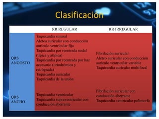 Clasificación
RR REGULAR RR IRREGULAR
QRS
ANGOSTO
Taquicardia sinusal
Aleteo auricular con conducción
aurículo ventricular fija
Taquicardia por reentrada nodal
(típica y atípica)
Taquicardia por reentrada por haz
accesorio (ortodrómica y
retrógrada)
Taquicardia auricular
Taquicardia de la unión
Fibrilación auricular
Aleteo auricular con conducción
aurículo ventricular variable
Taquicardia auricular multifocal
QRS
ANCHO
Taquicardia ventricular
Taquicardia supraventricular con
conducción aberrante
Fibrilación auricular con
conducción aberrante
Taquicardia ventricular polimorfa
 