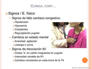 CLÍNICA, CONT…
 Signos / E. físico
 Signos de fallo cardiaco congestivo
 Hipotensión
 Hipoxemia
 Crepitantes
 Regurgitación yugular
 Cambios en estado mental
 Ansiedad, agitación
 Letargia o coma
 Signos de disociación AV
 Ondas “a” en cañón irregulares en yugular
 Intensidad variable de R1
 Cambios constantes en cada toma de la TA
DARÍO A. ADAMES ACOSTA
 