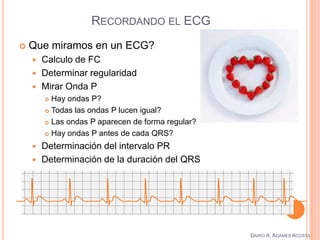 RECORDANDO EL ECG
DARÍO A. ADAMES ACOSTA
 Que miramos en un ECG?
 Calculo de FC
 Determinar regularidad
 Mirar Onda P
 Hay ondas P?
 Todas las ondas P lucen igual?
 Las ondas P aparecen de forma regular?
 Hay ondas P antes de cada QRS?
 Determinación del intervalo PR
 Determinación de la duración del QRS
 