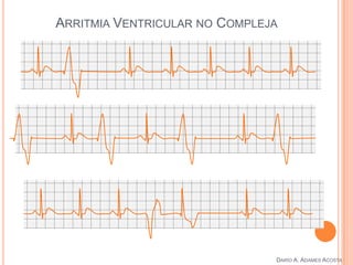 ARRITMIA VENTRICULAR NO COMPLEJA
DARÍO A. ADAMES ACOSTA
 