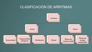 CLASIFICACIÓN DE ARRITMIAS
Arritmia
Activa
Extrasístole
Taquicardias
ectópicas Fibrilación Flutter
Pasiva
Ritmo de
escape nodal
Ritmo de
escape
ventricular
 