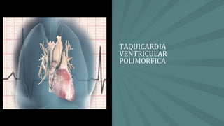 TAQUICARDIA
VENTRICULAR
POLIMORFICA
 